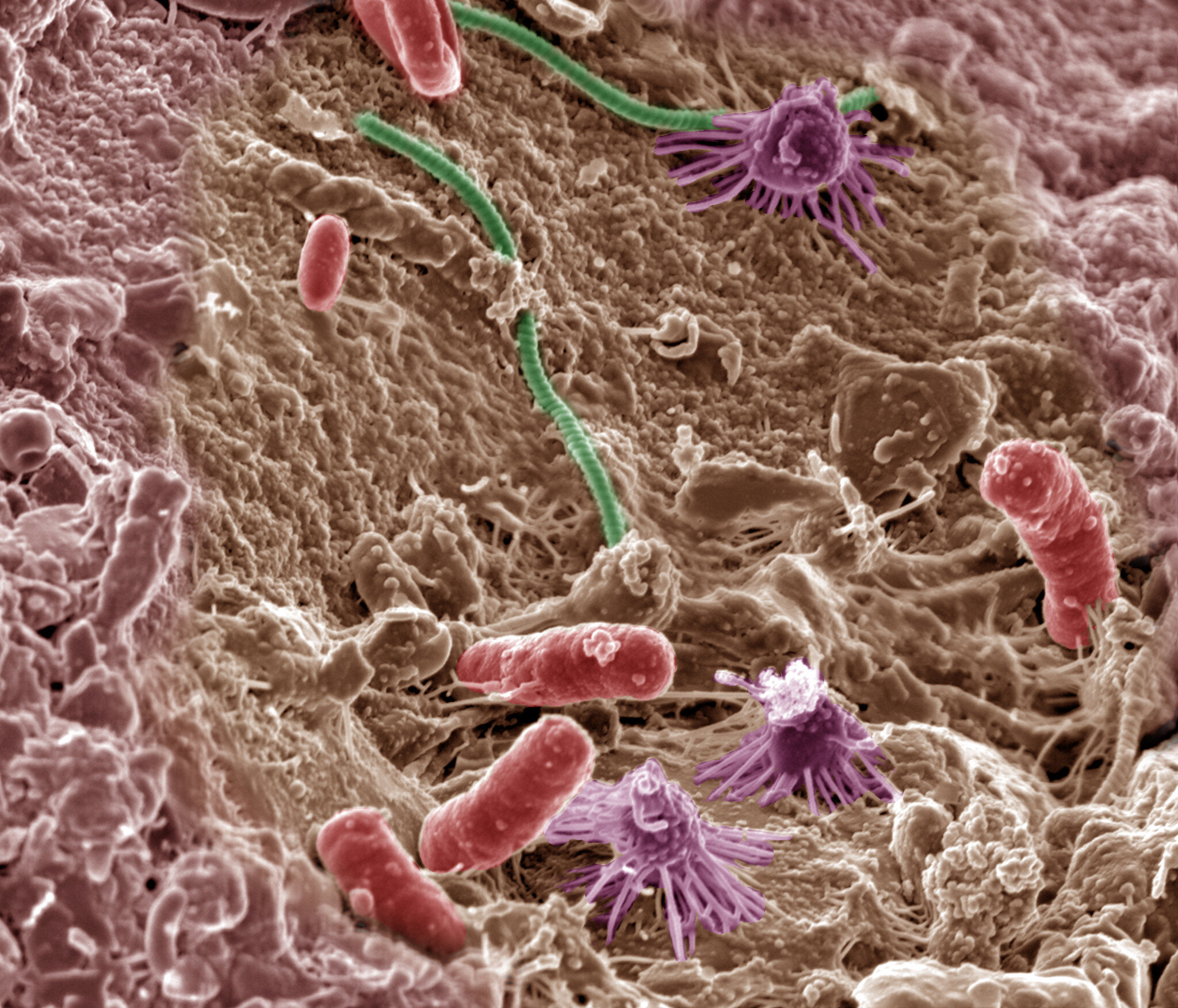 Transplanting Microbes from a Young Mouse into an Old One Reverses Age-Related Cognitive Decline